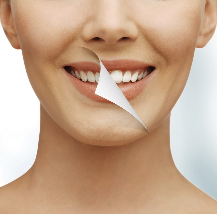 blanchiment des dents décryptage sourire tendances dentaires femmes hommes tout savoir