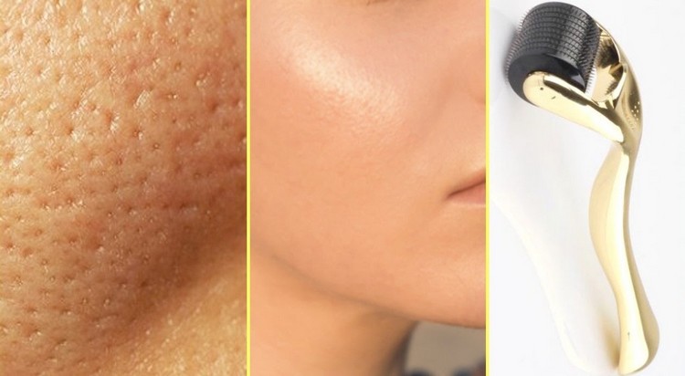 roller visage avis résultats astuces utilisation produit révolutionnaire soin peau