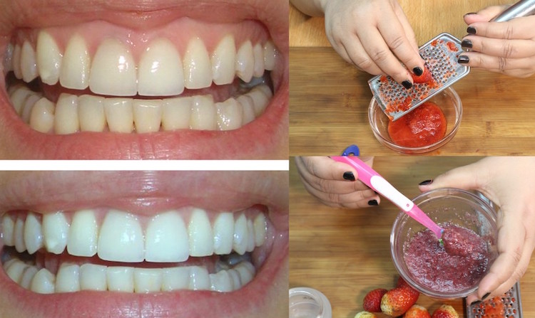 bienfaits des fraises beauté blanchir ses dents
