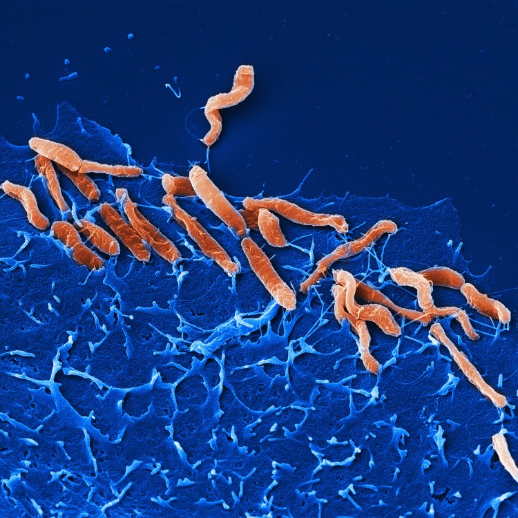 bactérie helicobacter pylori décryptage diagnostic traitement aliments sains consommer