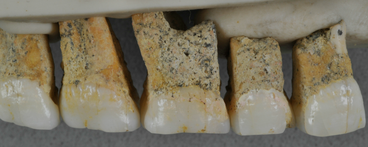 nouvelle espece humaine decouverte Philippines homo luzonensis dents