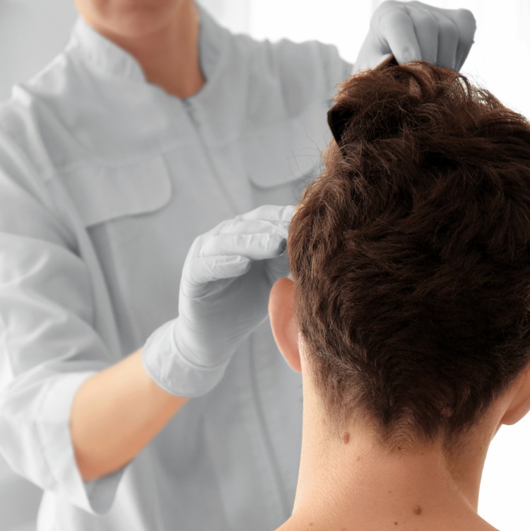 traitement perte de cheveux consulter un médecin