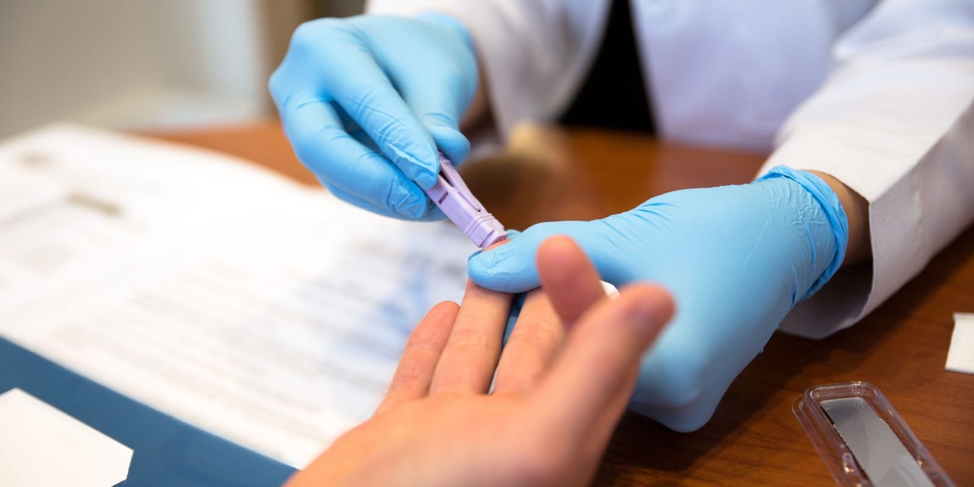 test du VIH gratuit sans ordonnance laboratoires Paris département Alpes Maritimes
