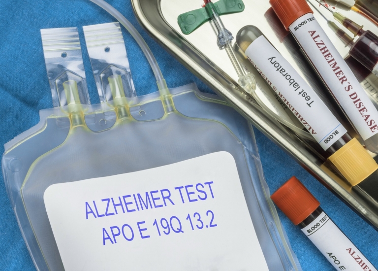 maladie d'Alzheimer effets néfastes du BPA