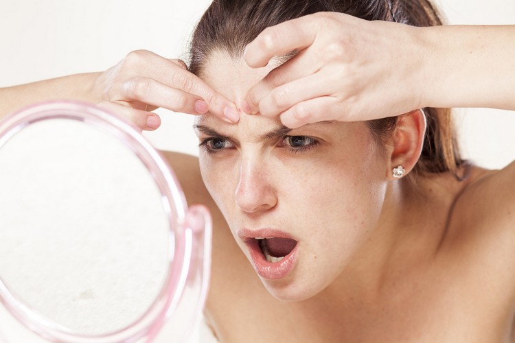 causes acné mythes hormones puberté adultes