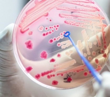 sepsis causes infection du sang nouvelle étude The Lancet