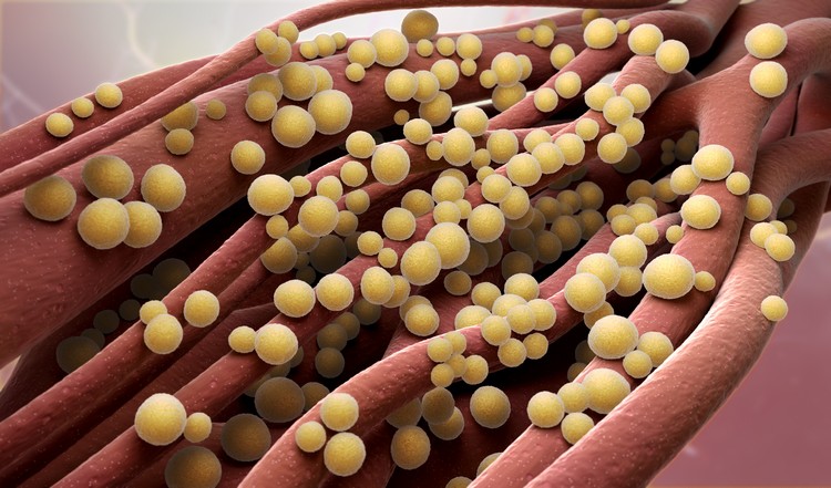 staphylococcus aureus bactéries courantes salles de sport comment se protéger
