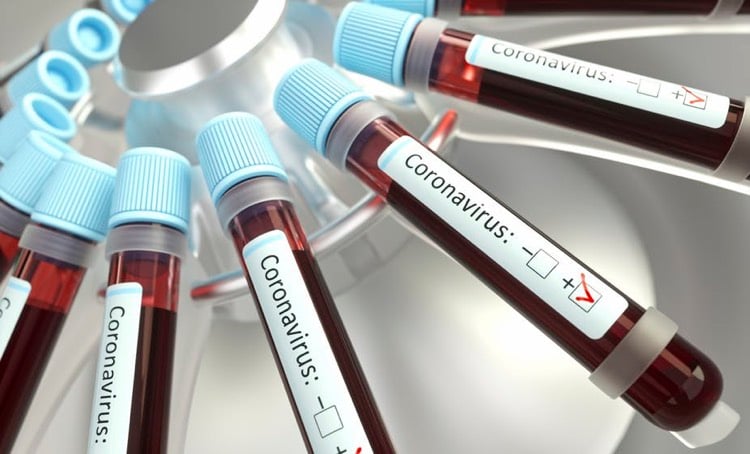 tubes essai sang coronavirus