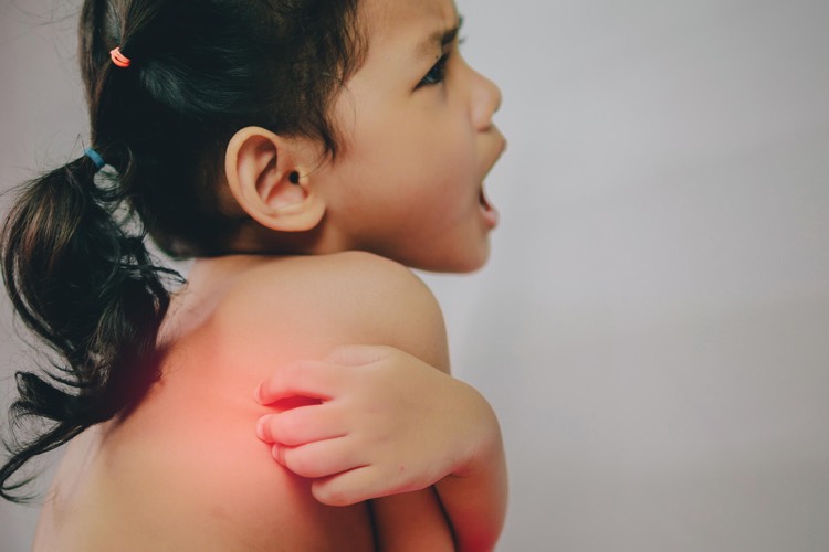 allergie au soleil enfant dermatite de contact reaction produit chimique avec le soleil