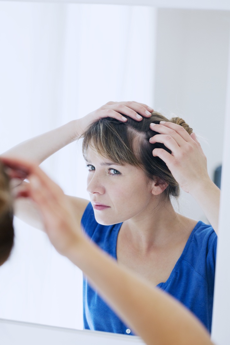 alopécie chute de cheveux importante causes stress accouchement