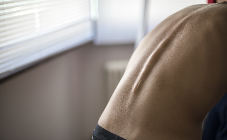 lombalgie mal de dos suite a une mauvaise posture solutions