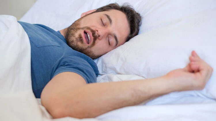 fatigue matinale apnée de sommeil langue grasse