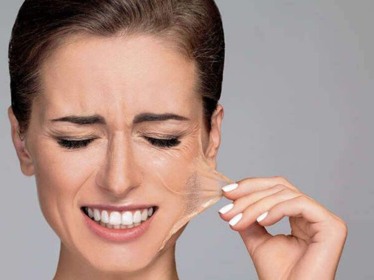 peeling visage chimique complications possibles peeling profond