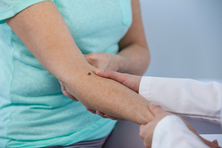 vaccin contre le mélanome médicament personnalisé étude prometteuse cancer de la peau NeoVax