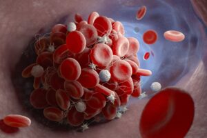 coagulation sanguine formation caillots sanguins processus naturel