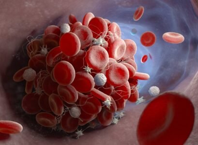 coagulation sanguine formation caillots sanguins processus naturel