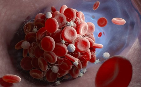coagulation sanguine formation caillots sanguins processus naturel