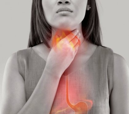 reflux gastrique symptômes gorge brûlures d'estomac