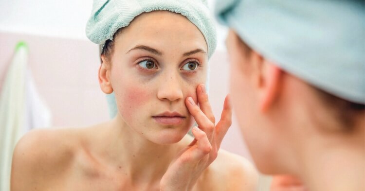 safran poudre bienfaits traitement acné