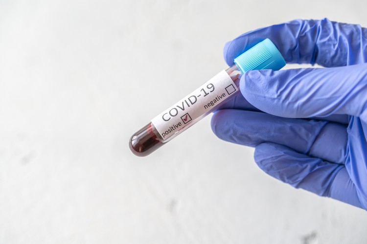 dépistage du coronavirus nouvelle méthode prélèvement d'échantillons cutanés étude