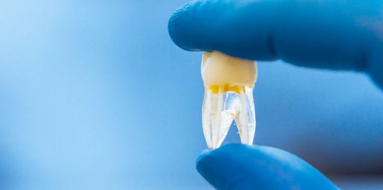 faire repousser les dents grâce à un anticorps monoclonal régénération dentaire étude japonaise