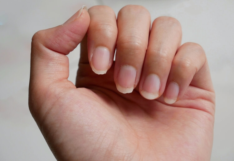 symptômes carence en fer ongles endommagés
