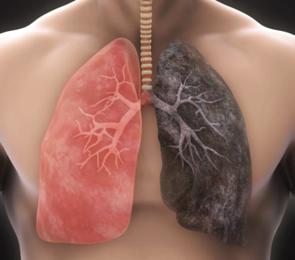 Comment nettoyer les poumons