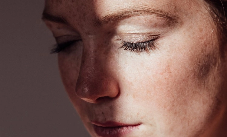 Comment traiter l hyperpigmentation naturellement