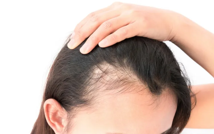 chute de cheveux causes externes maladies homme femme après covid