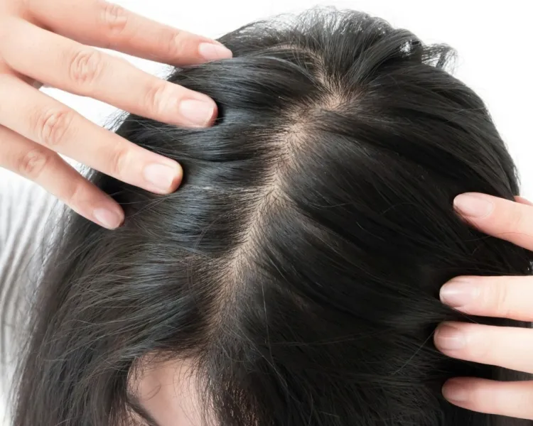 chute de cheveux traitement arrêter ralentir perte poils