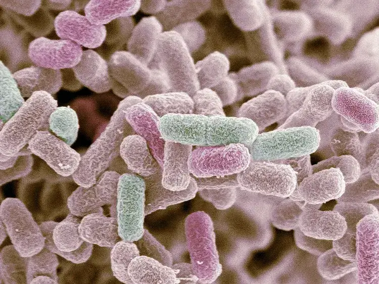 escherichia coli quels aliments risque comment traiter pour prévenir infection
