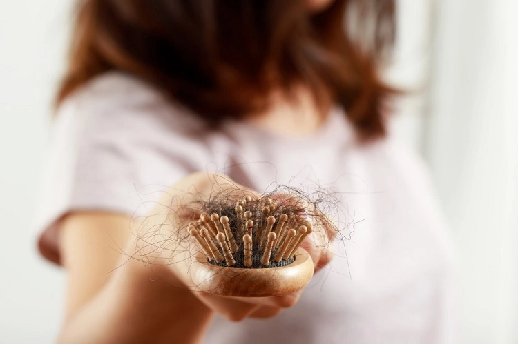 perte de cheveux femme