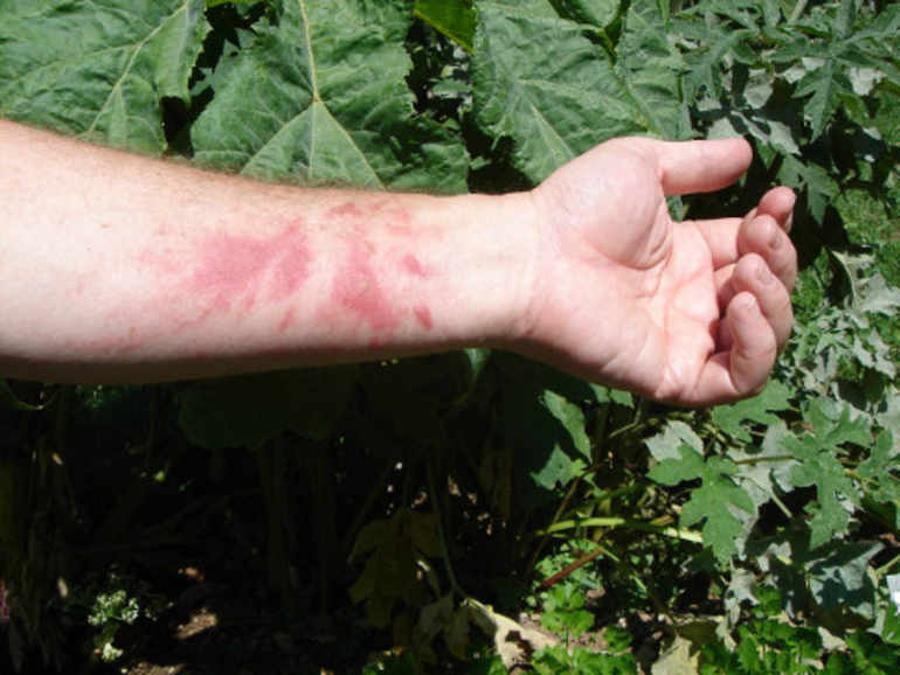 plantes allergisantes