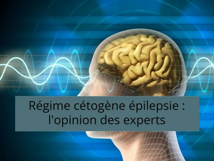 régime cétogène épilepsie recette étude menée enfants réduire nombre crises