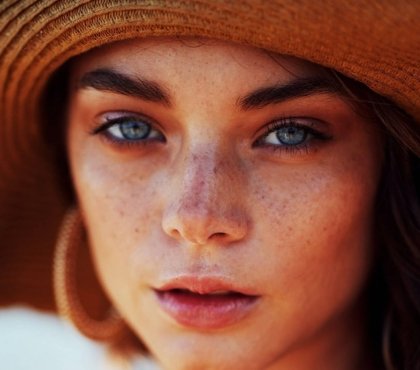 photosensibilité peau visage sensible soleil allergie solaire traitement prévention actifs cosmétiques à éviter