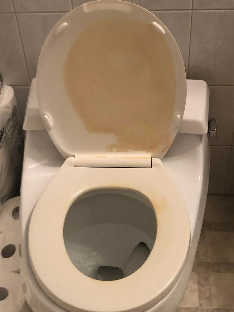 comment enlever tache urine sur abattant wc
