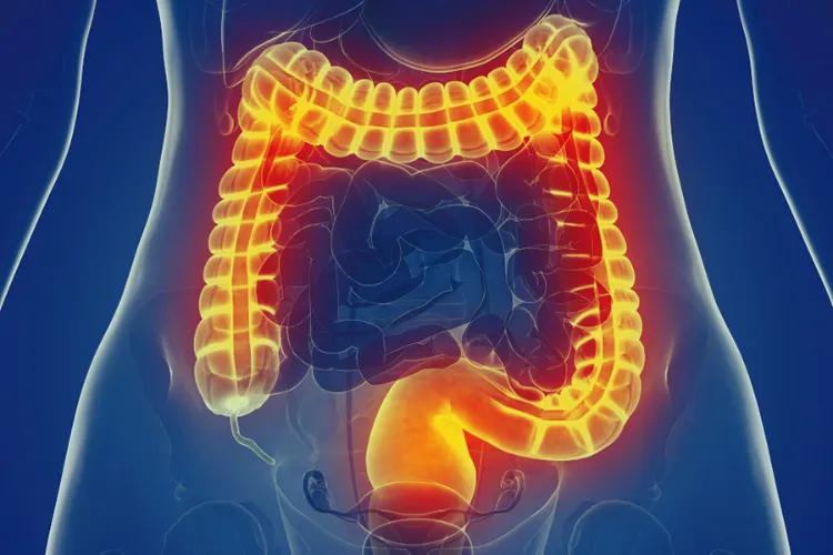 mal aux intestins ventre gonflé quelles causes que faire syndrome colon irritable