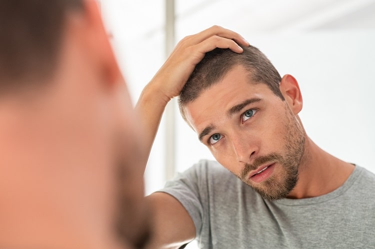 perte de cheveux homme femme greffe de cheveux turquie avant après 2022