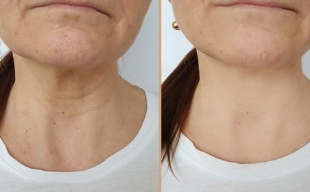 comment enlever naturellement les rides de la potrine femme 50 ans masque visage gommage massage exercices