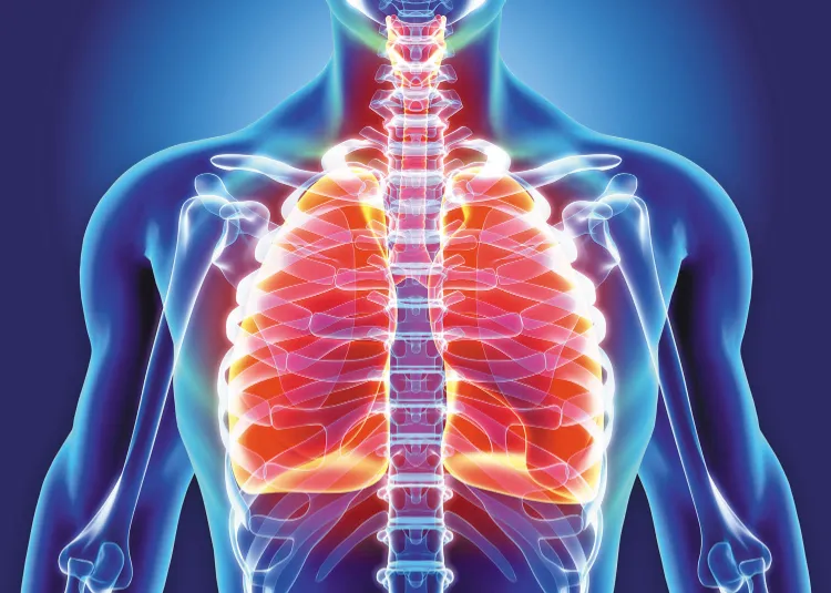 comment soigner bronchite aigue mesures faire passer plus vite inflammation virale
