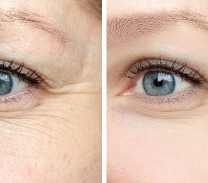 comment rajeunir le contour des yeux naturellement après 50 ans