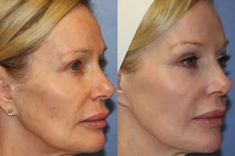 meilleure crème visage femme 60 ans