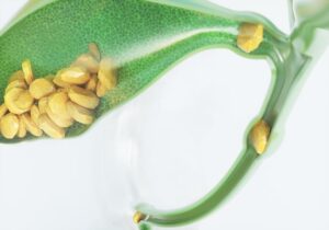 nettoyer vésicule biliaire santé bien être regime