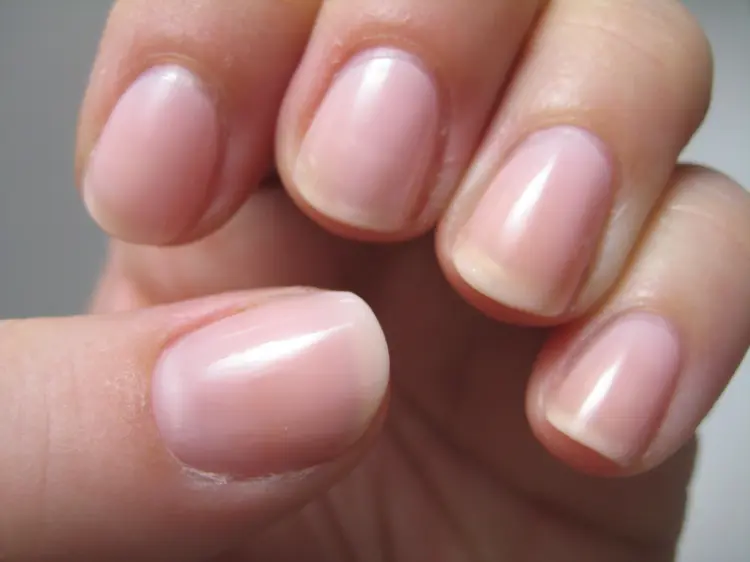 causes ongles striés dans longueur largeur comment avoir ongles sains