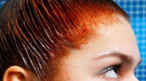 comment enlever les taches de coloration de la peau méthodes simples astuces