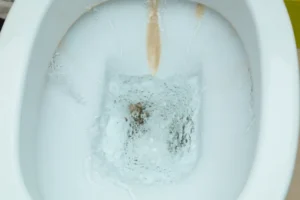 calcaire dans les toilettes