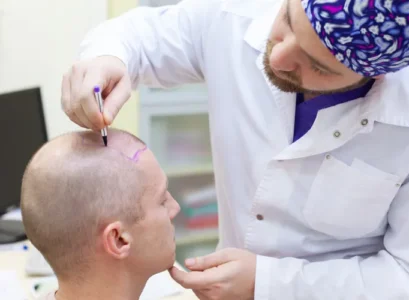 se faire greffer des cheveux en turquie