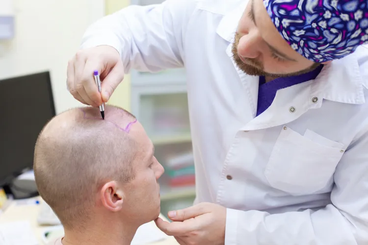 se faire greffer des cheveux en turquie