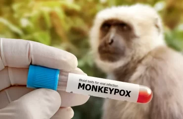 quels sont les symptômes de la variole du singe en 2024