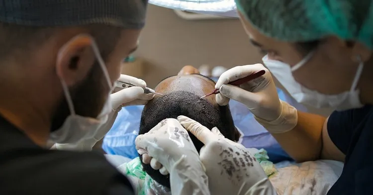 technique de transplantation capillaire